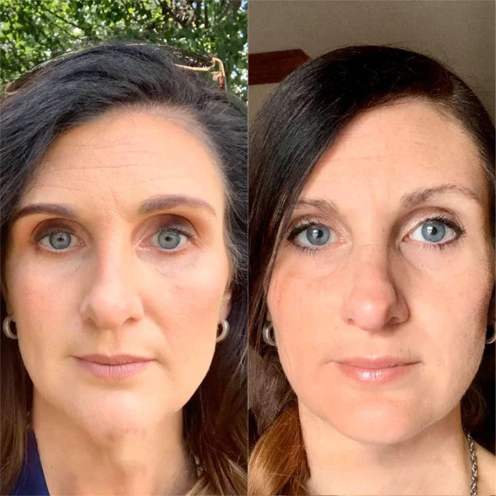 Tracy before and after SkinnyFit Super Youth
