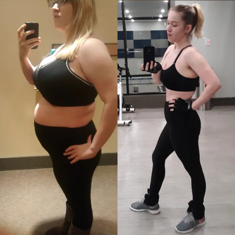 Miriam R., before and after