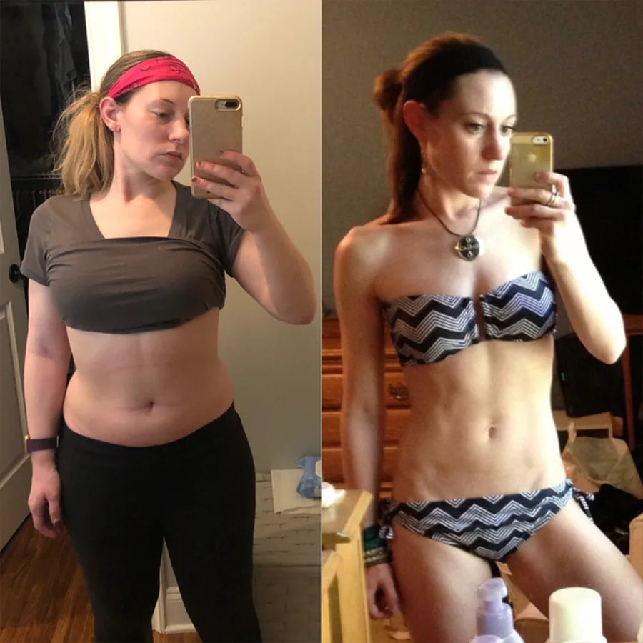Laura R., before and after on SkinnyFit