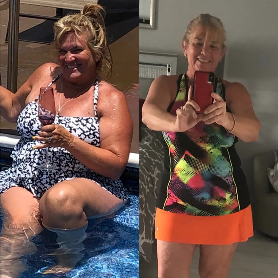 Melinda S., before and after on SkinnyFit