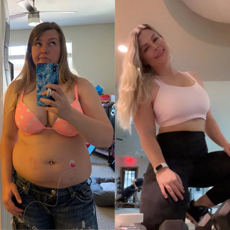 Merissa B., before and after on SkinnyFit