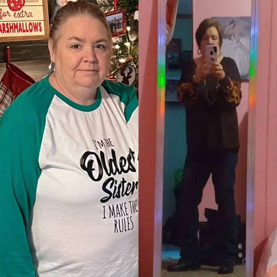 Vicki C., before and after on SkinnyFit