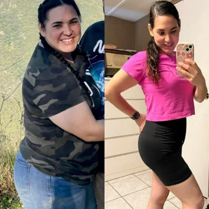 Vanessa C., before and after